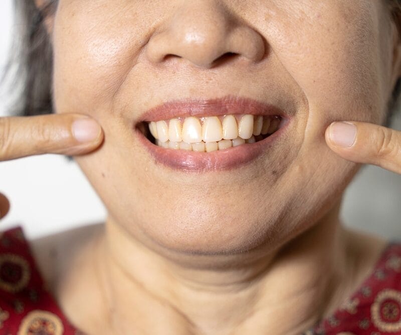 An elderly Asian smile with her new dentures.