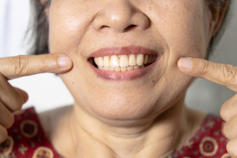 An elderly Asian smile with her new dentures.