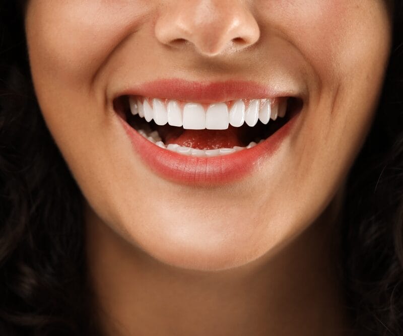 Closeup view of smiling woman. Dental veneers