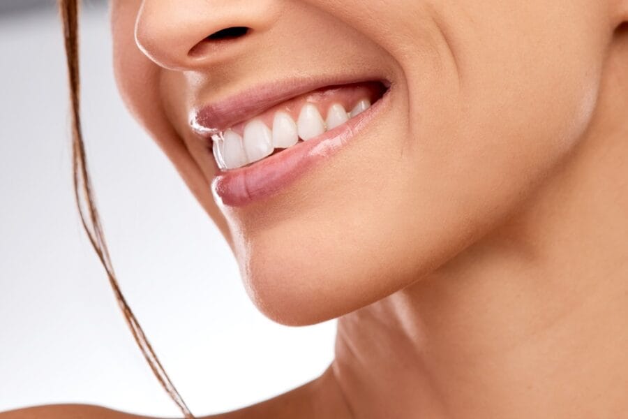Smile, woman and dental with mouth in studio for hygiene, teeth whitening and orthodontic results. Person, happiness or veneers with oral care, fresh breath and cosmetic treatment on white background